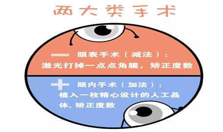 最新近視矯正技術(shù),最新近視矯正技術(shù)，重塑清晰視界